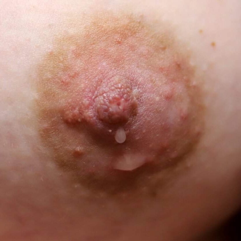 Colostrum production with hand expression in third trimester of pregnancy