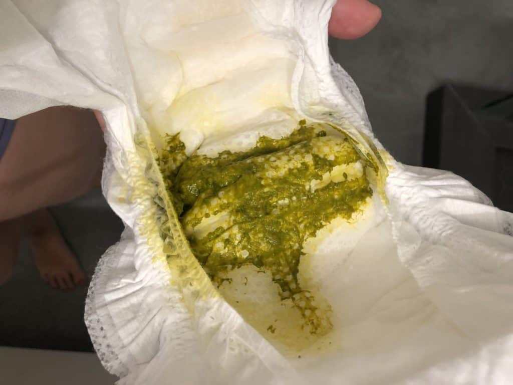 Stools with improving hyperlactation