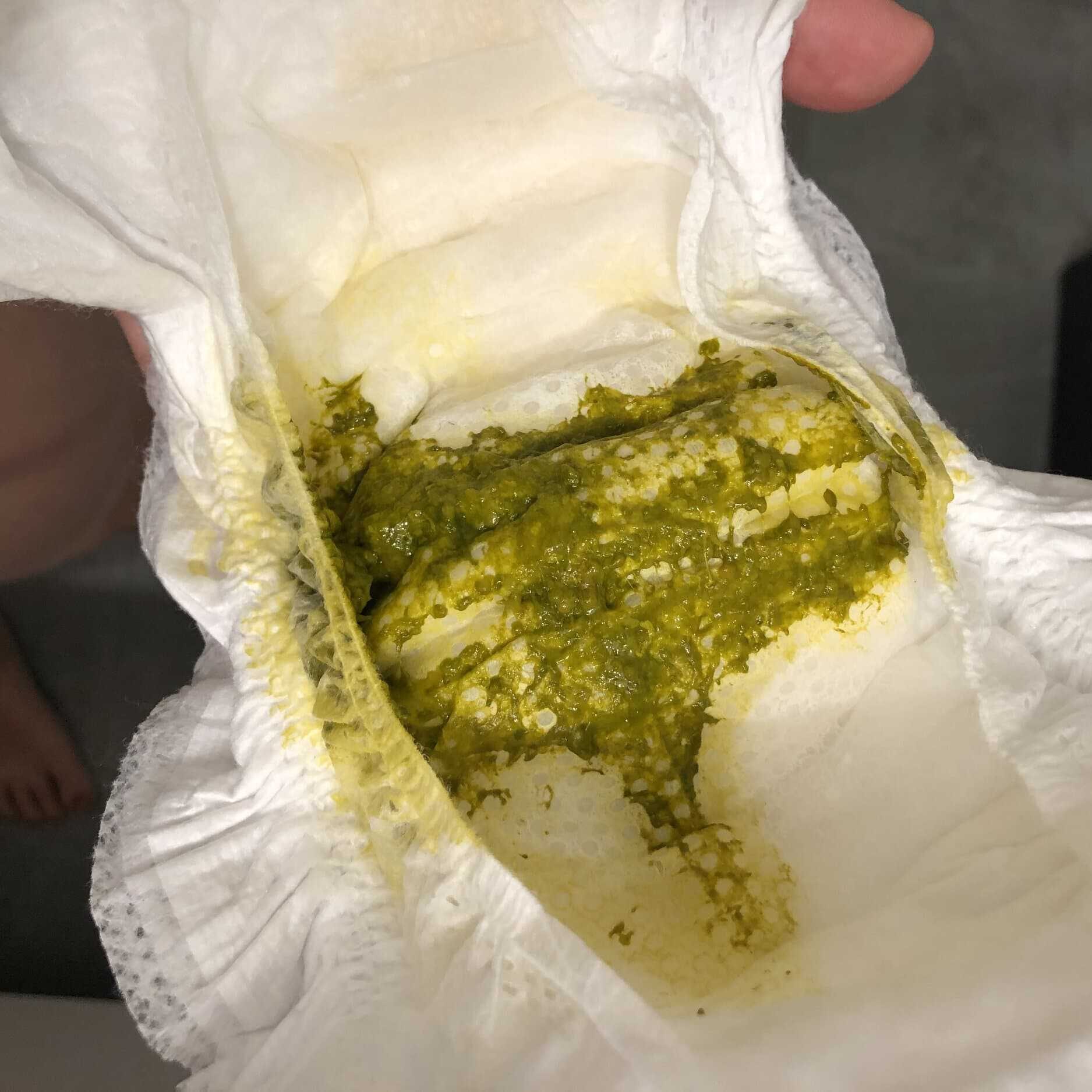 Stools with improving hyperlactation