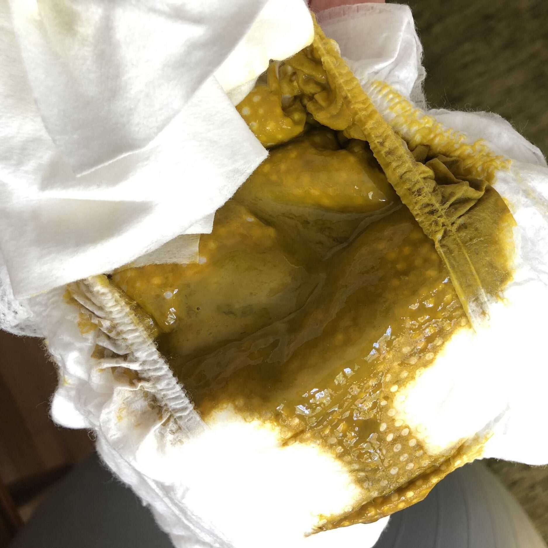 Stools with hyperlactation