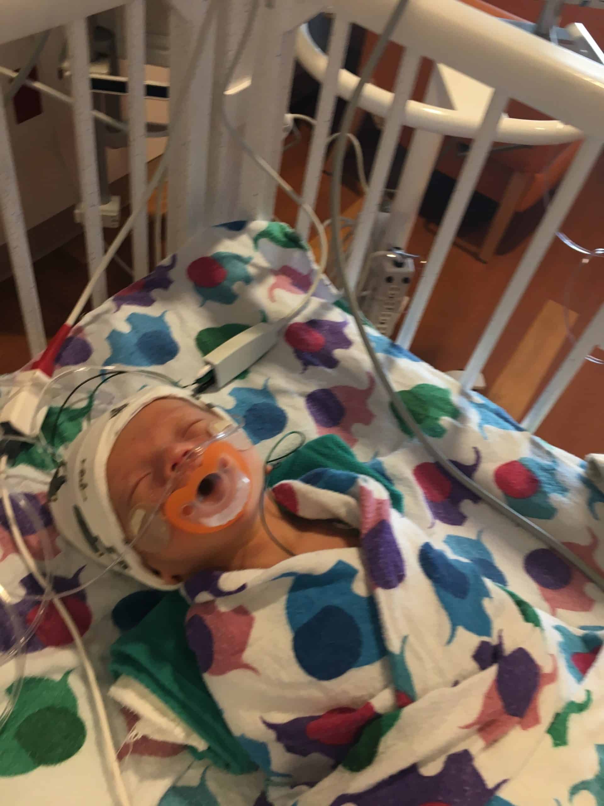 Baby in NICU bed