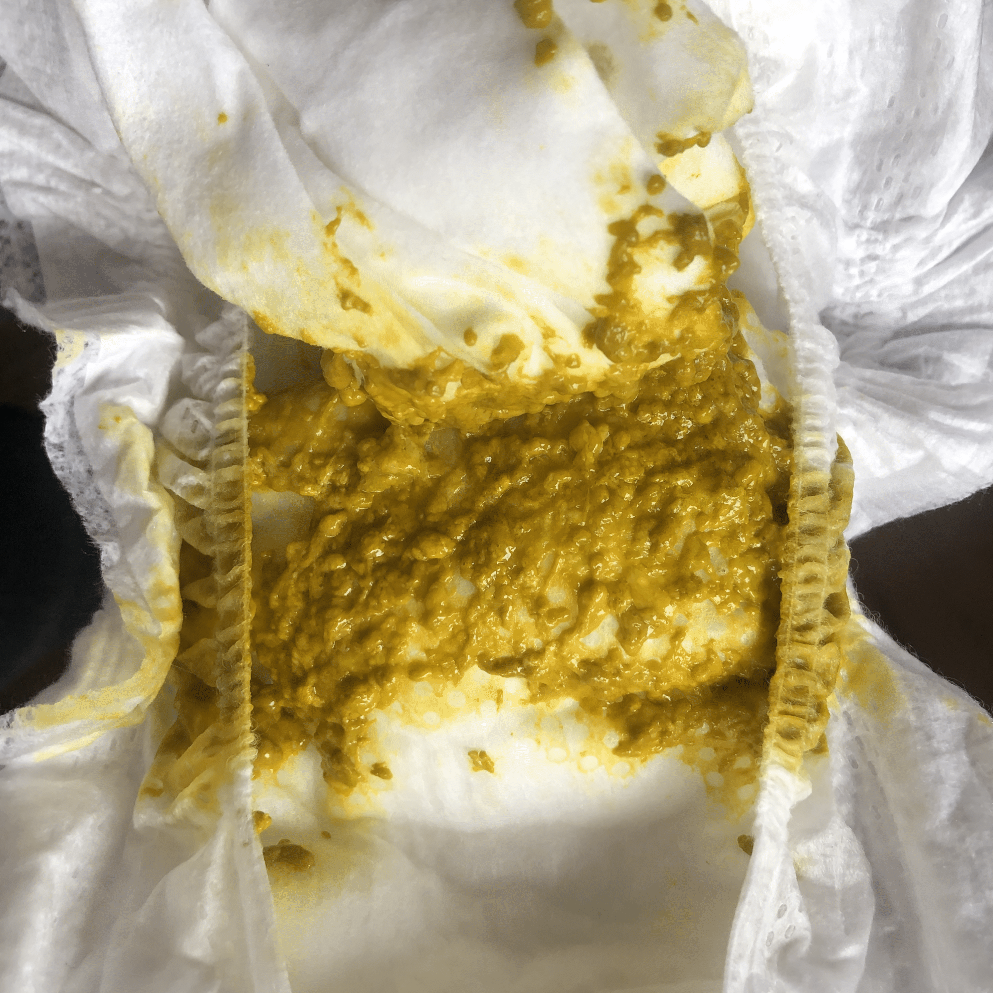 Seedy, yellow stool representing adequate breastmilk consumption.