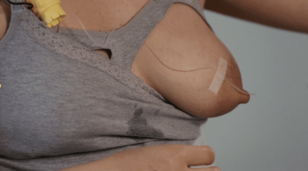 IABLE photo showing a supplemental nursing system