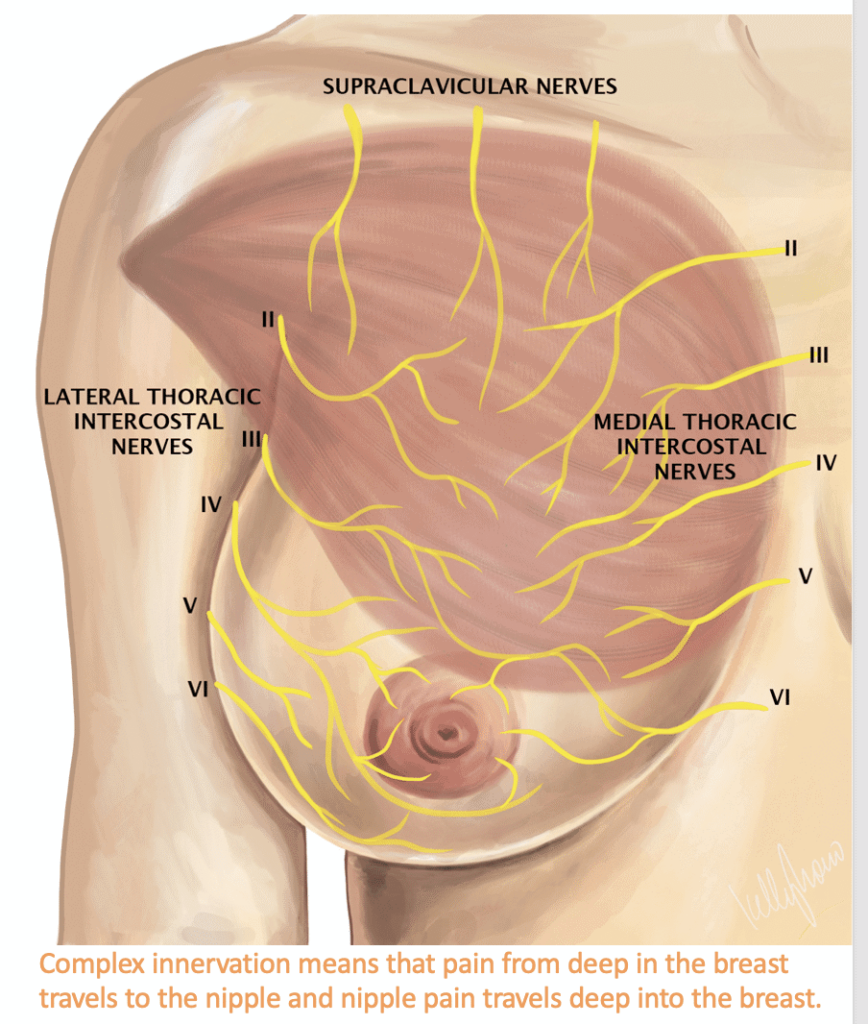 Complex inervention with diagram of muscle of the breasts