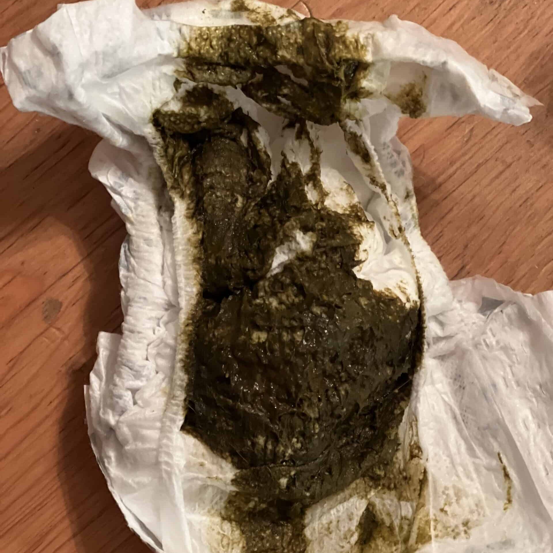 Dark poopy Diaper