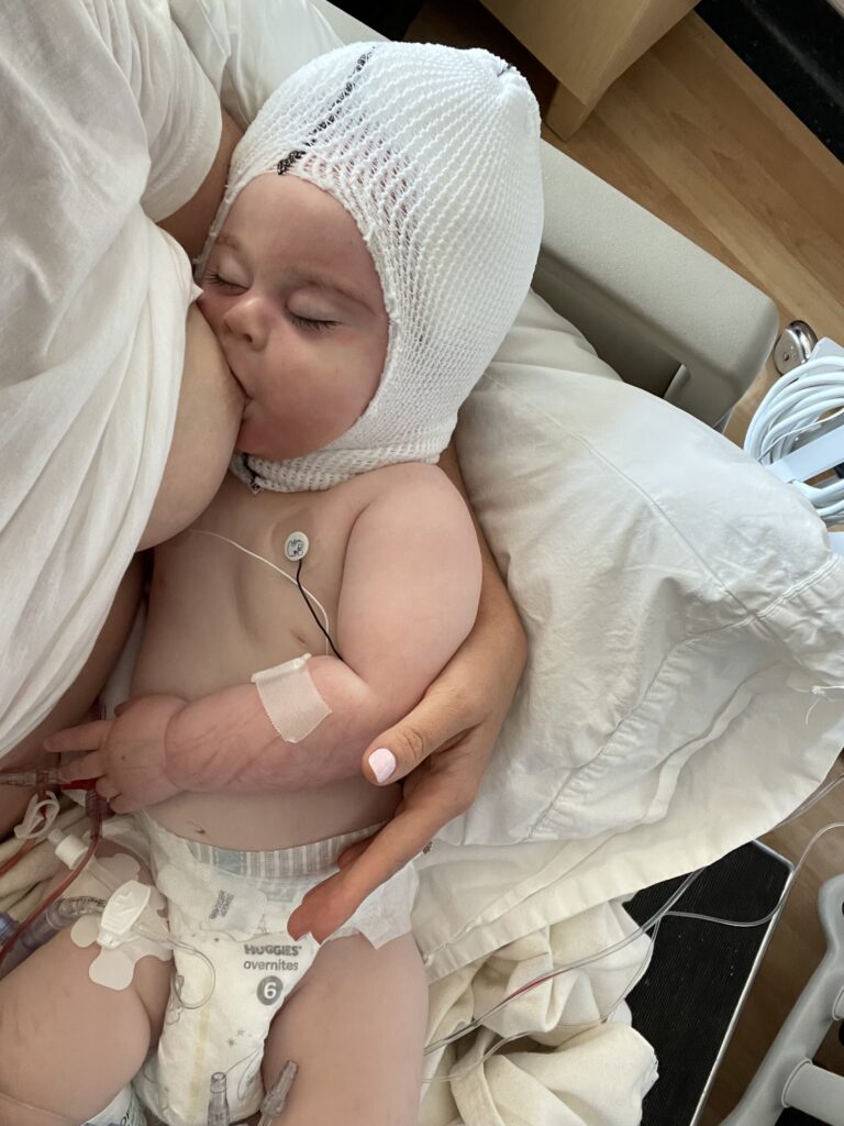 Baby nursing after brain surgery