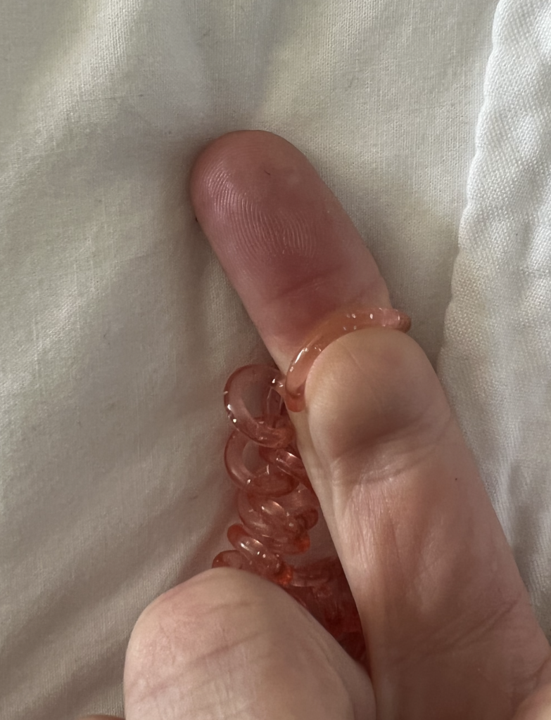Finger ischemia with pumping