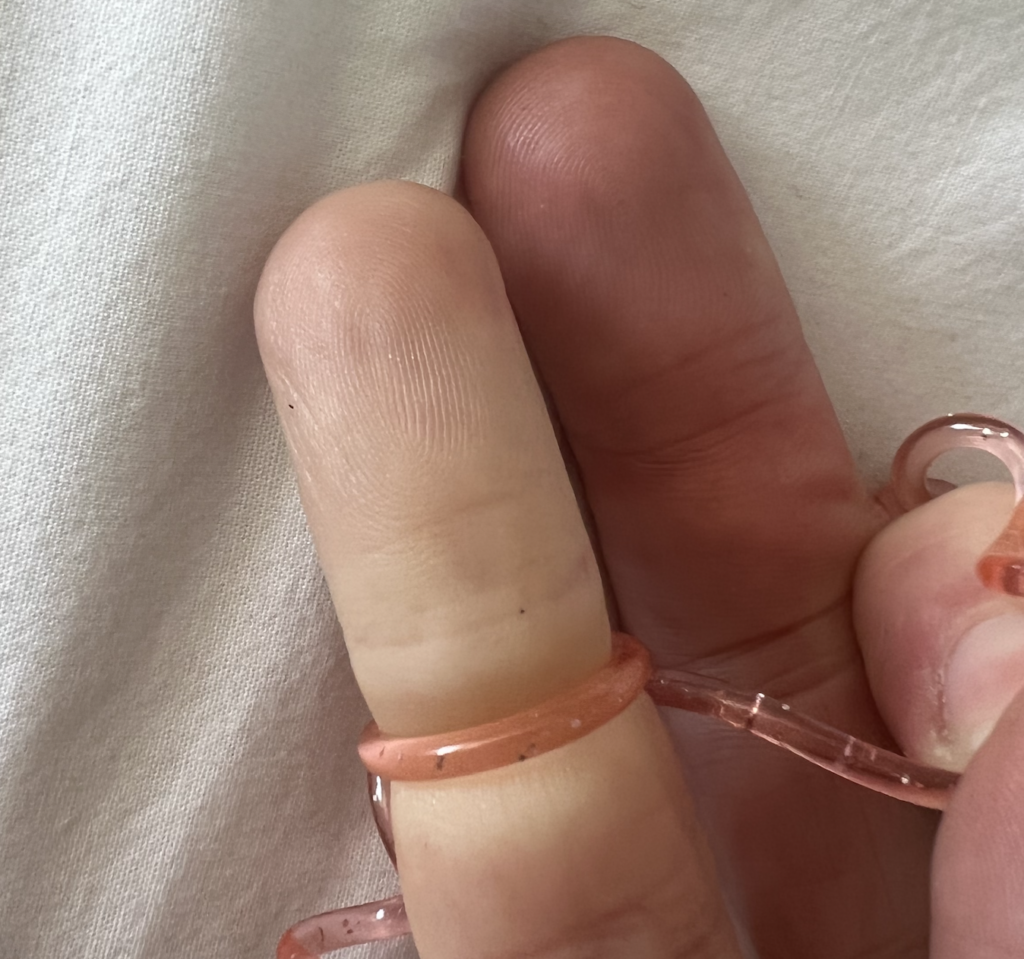 Loss of blood flow to finger like a pump does