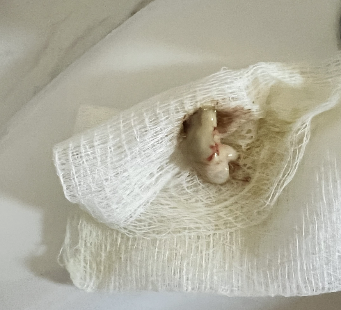 dead tissue from massage