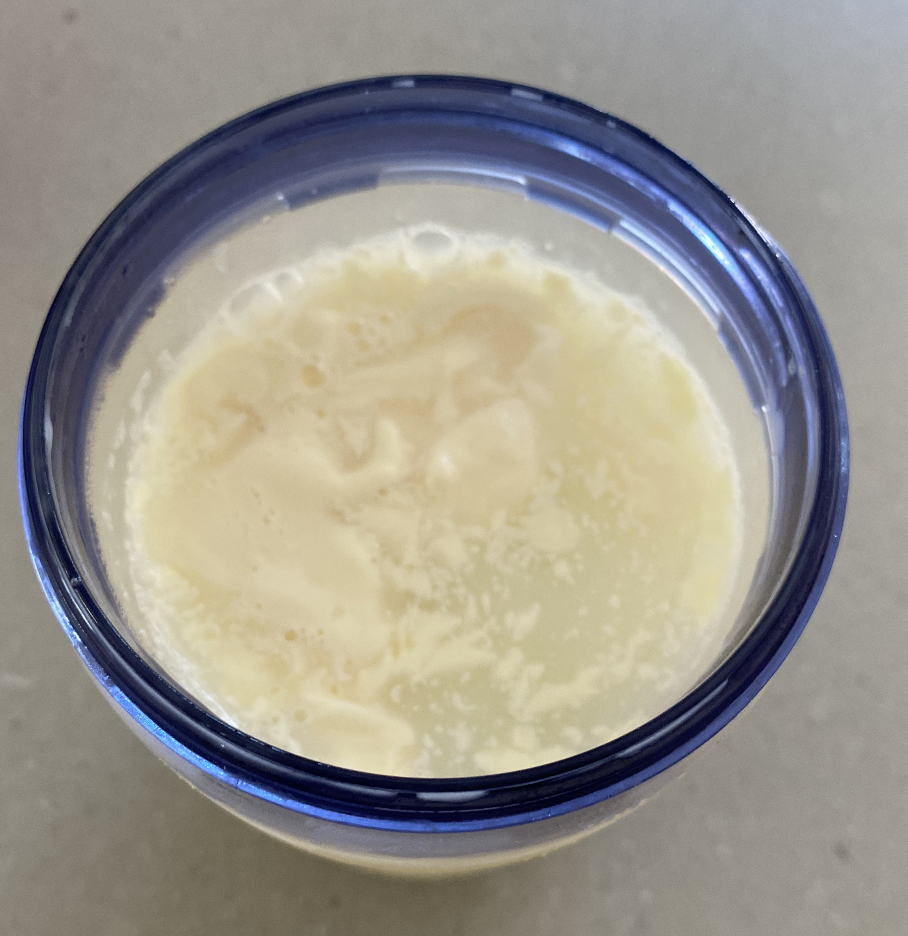 clumpy fat globules in breastmilk