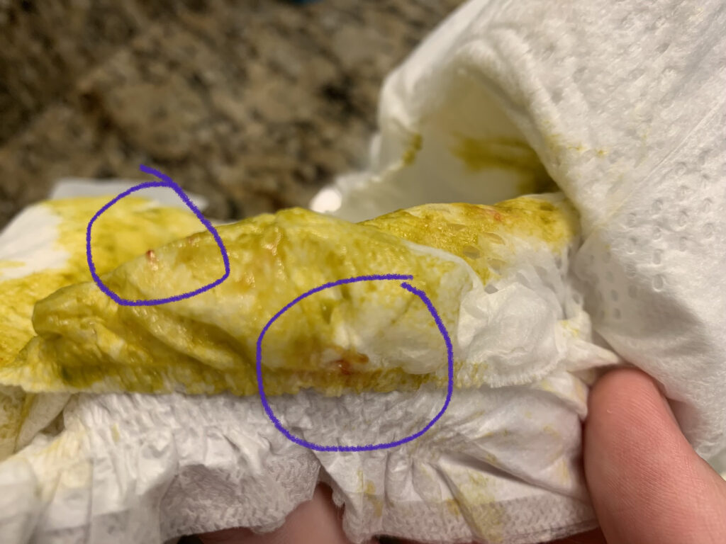 Streaks of blood in stool with oversupply