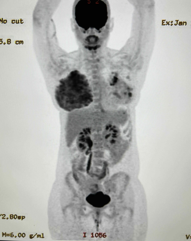 metabolic activity of the breast during lactation