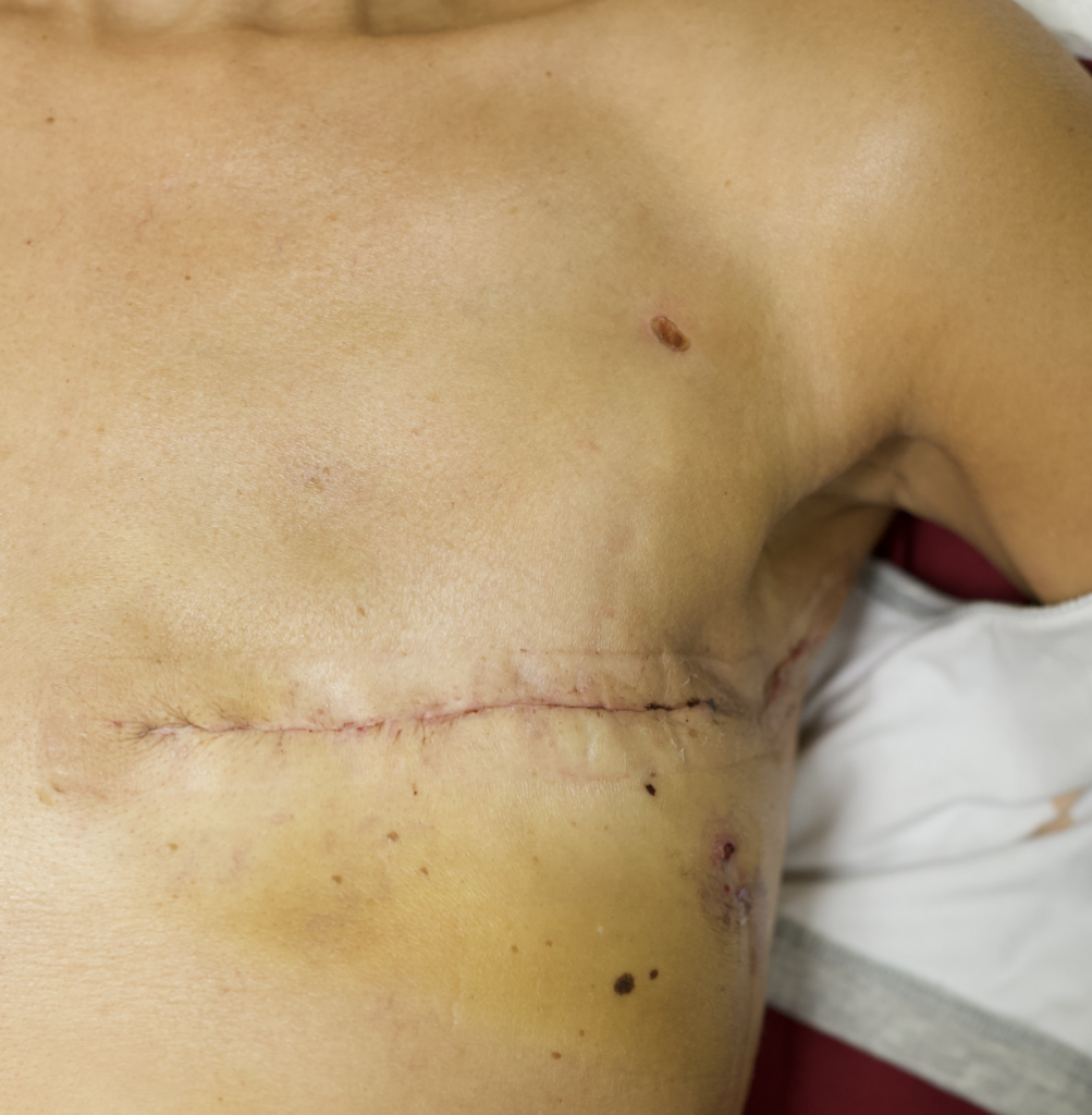 Flat Aesthetic Closure