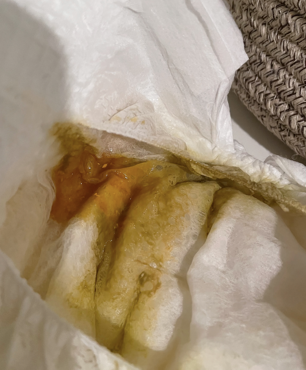 Oversupply and bloody diaper