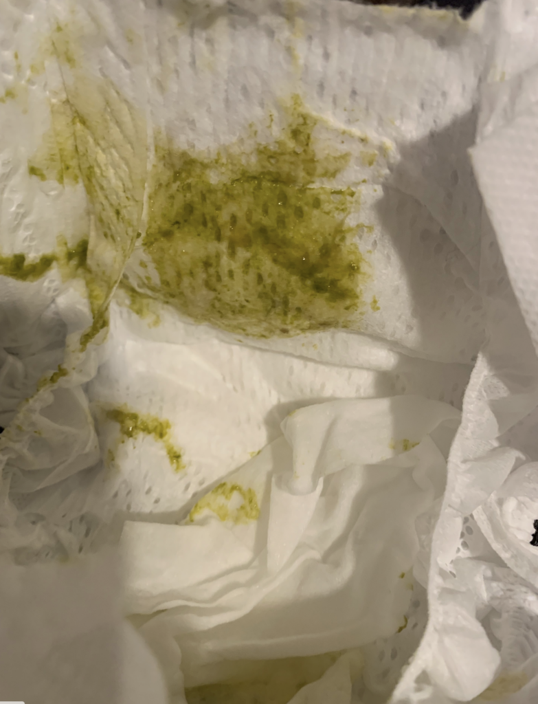 green diaper hyperlactation