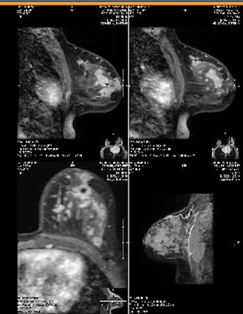 Screen Shot 2023 01 08 at 3.24.25 PM