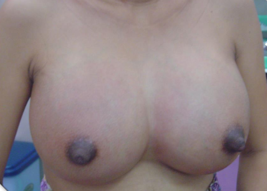 Sirilak Thavornwattana, Pediatric APN, Thailand