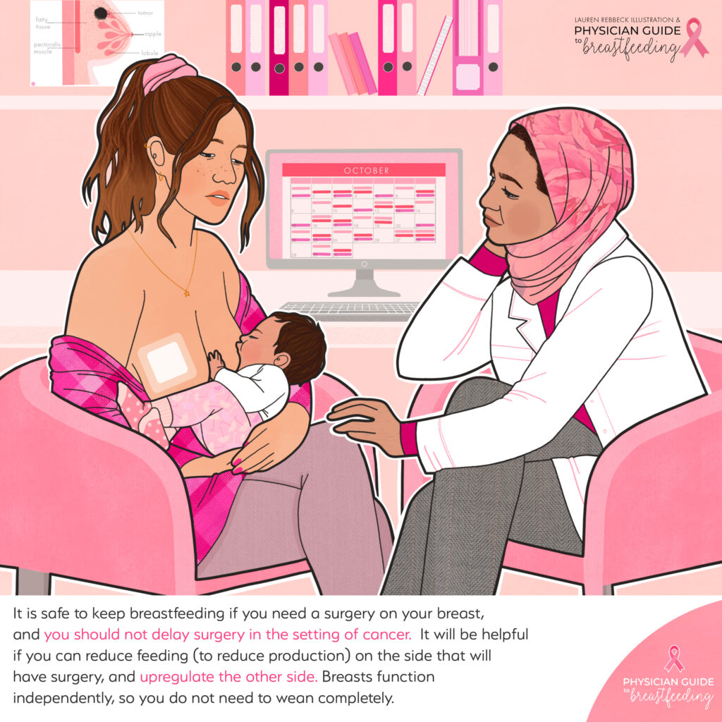 Breastfeeding and breast surgery