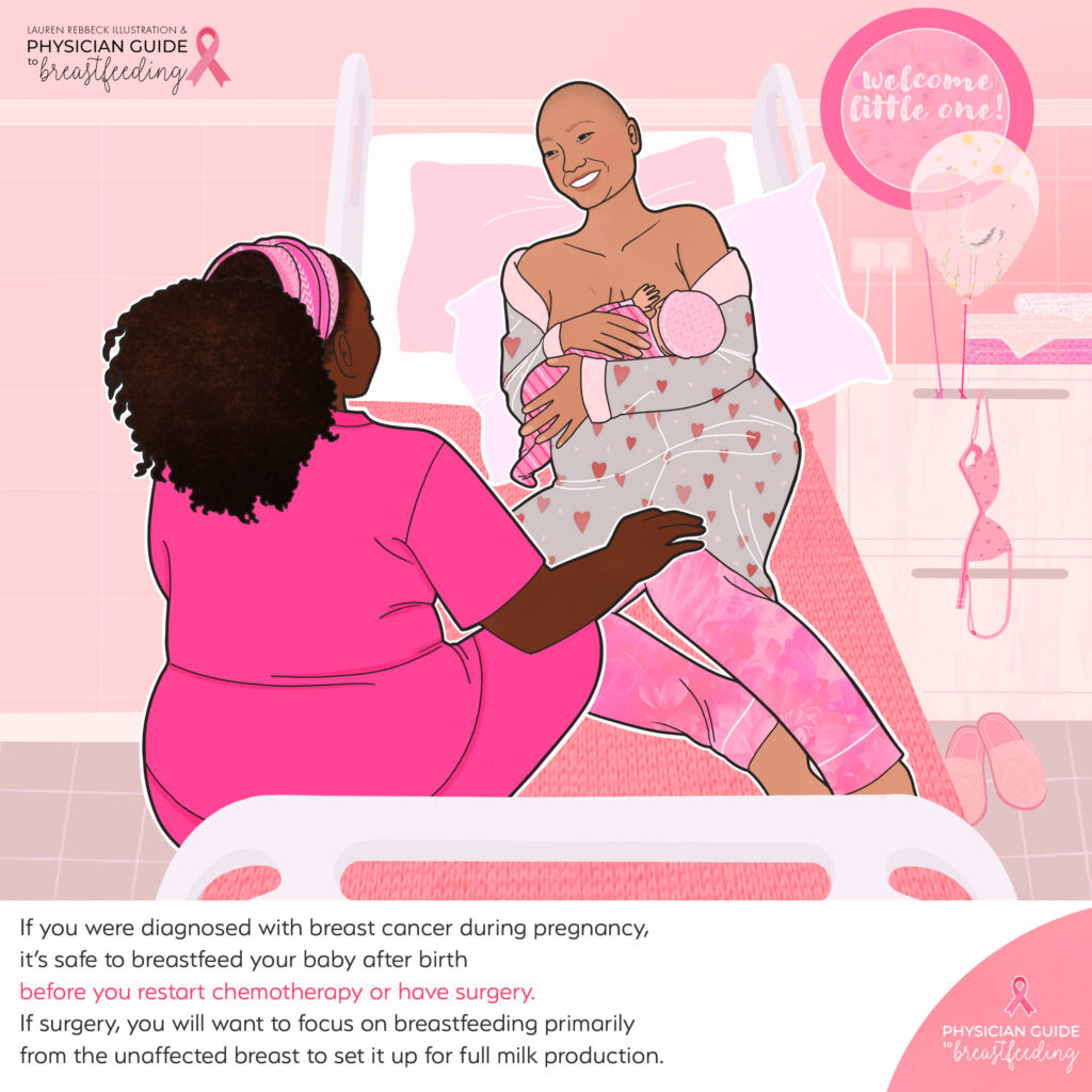 Breastfeeding after chemotherapy in pregnancy