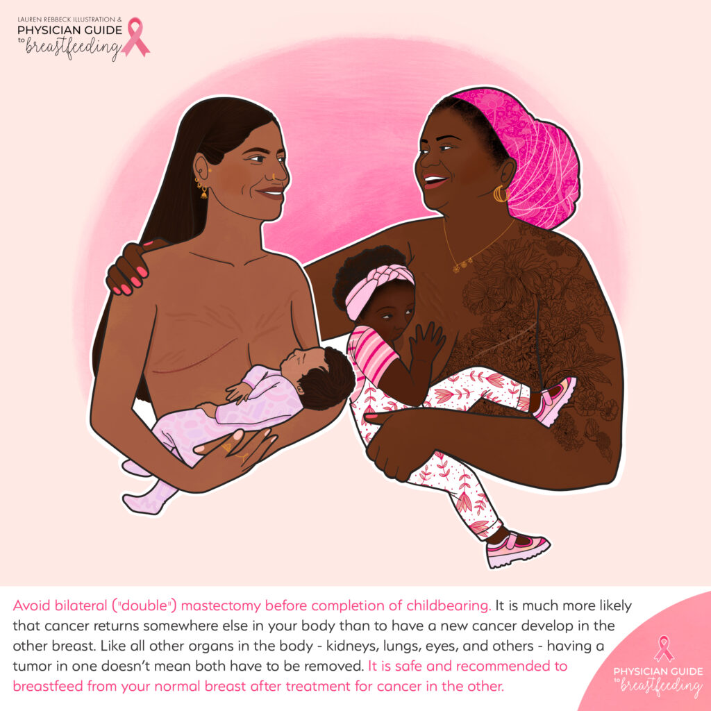 Breastfeeding after breast cancer surgery