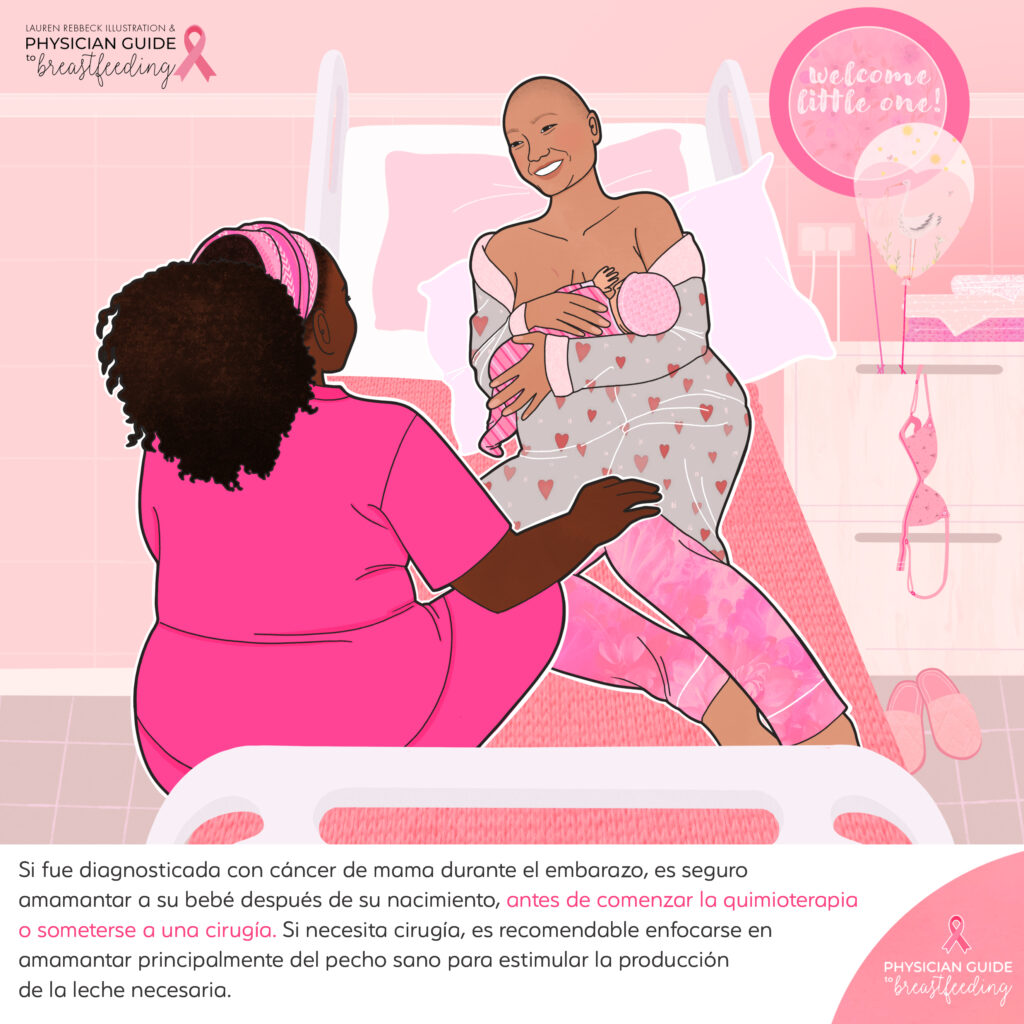 Oncolactation Spanish