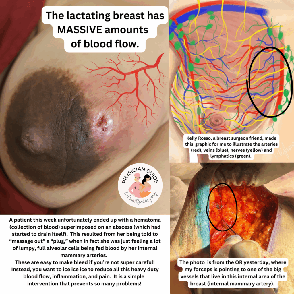 The lactating breast has massive amounts of blood flow.