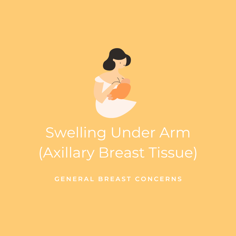 Swelling Under Arm (Axillary Breast Tissue) - General Breast Concerns Graphic